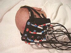 新生児の視覚野測定におけるプローブのセッティング