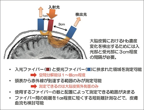 NIRSの原理と特徴