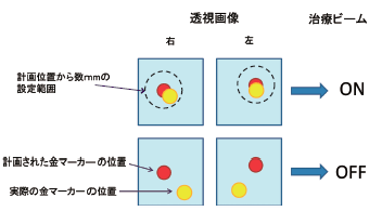 動体追跡と治療ビーム照射の関係(イメージ図)