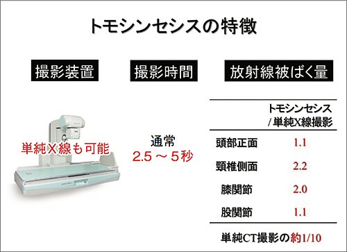 TOMOSの特徴
