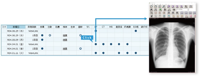 一行カルテビュー