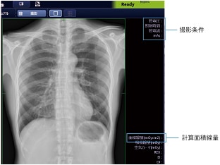 条件設定と情報管理が容易（オプション）