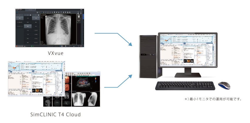 VXvueと電子カルテの画面を1モニタで切替る説明の図解