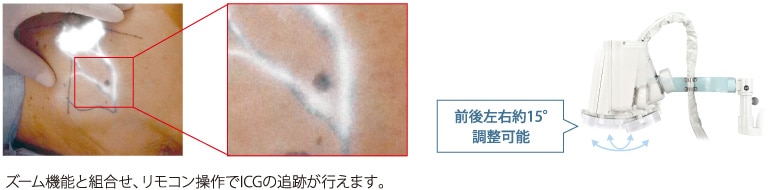 視野調整可能なリモート雲台（オプション）