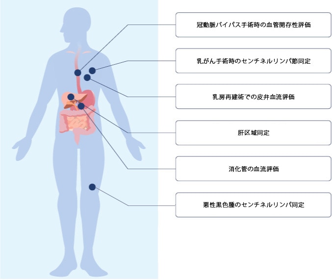 臨床応用の拡大