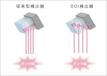 乳房用に最適化した最新DOI技術搭載