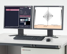 収集・処理コンピュータの統合