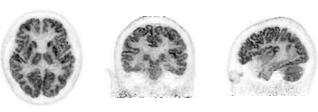 薬剤分布を明瞭に描出