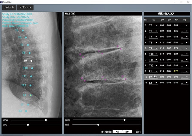椎体計測ソフトウェアSmart QM体験版