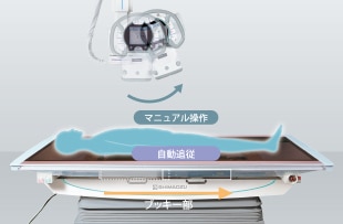 ブッキー部の照射野自動追随