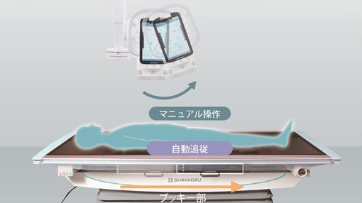 ブッキー部の照射野自動追随