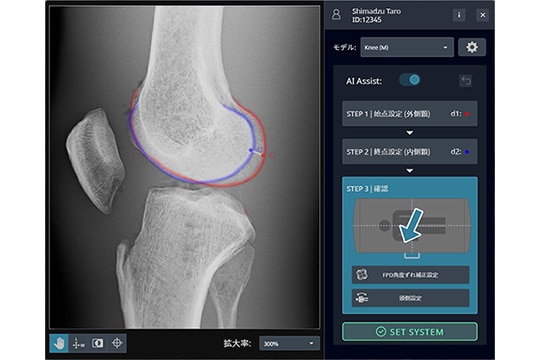位置補正用画像解析オプション Ortho-Navi