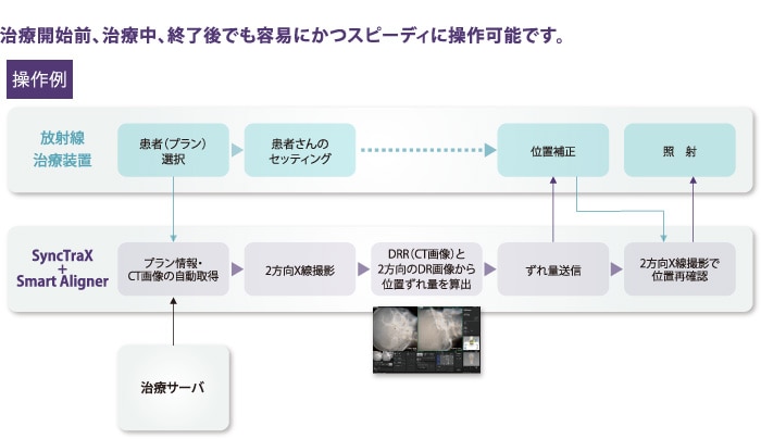 治療開始前、治療中、終了後も容易かつスピーディーに操作可能