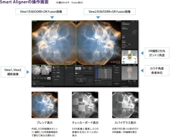 治療開始前、治療中、終了後も容易かつスピーディーに操作可能