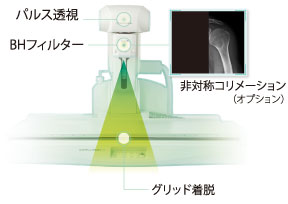 徹底した被ばく低減 Low Dose Control