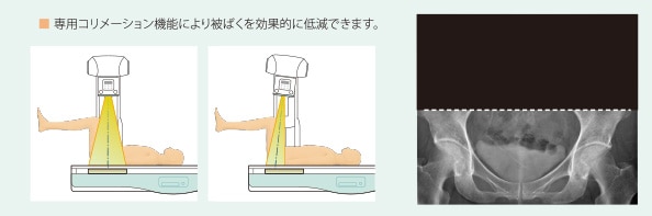 専用コリメーション機能が被ばくを低減