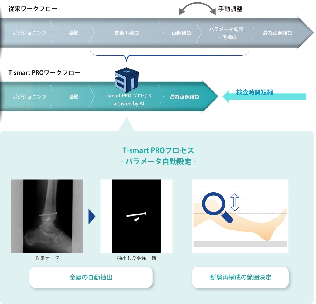 深層学習技術によるトモシンセシス検査の効率化