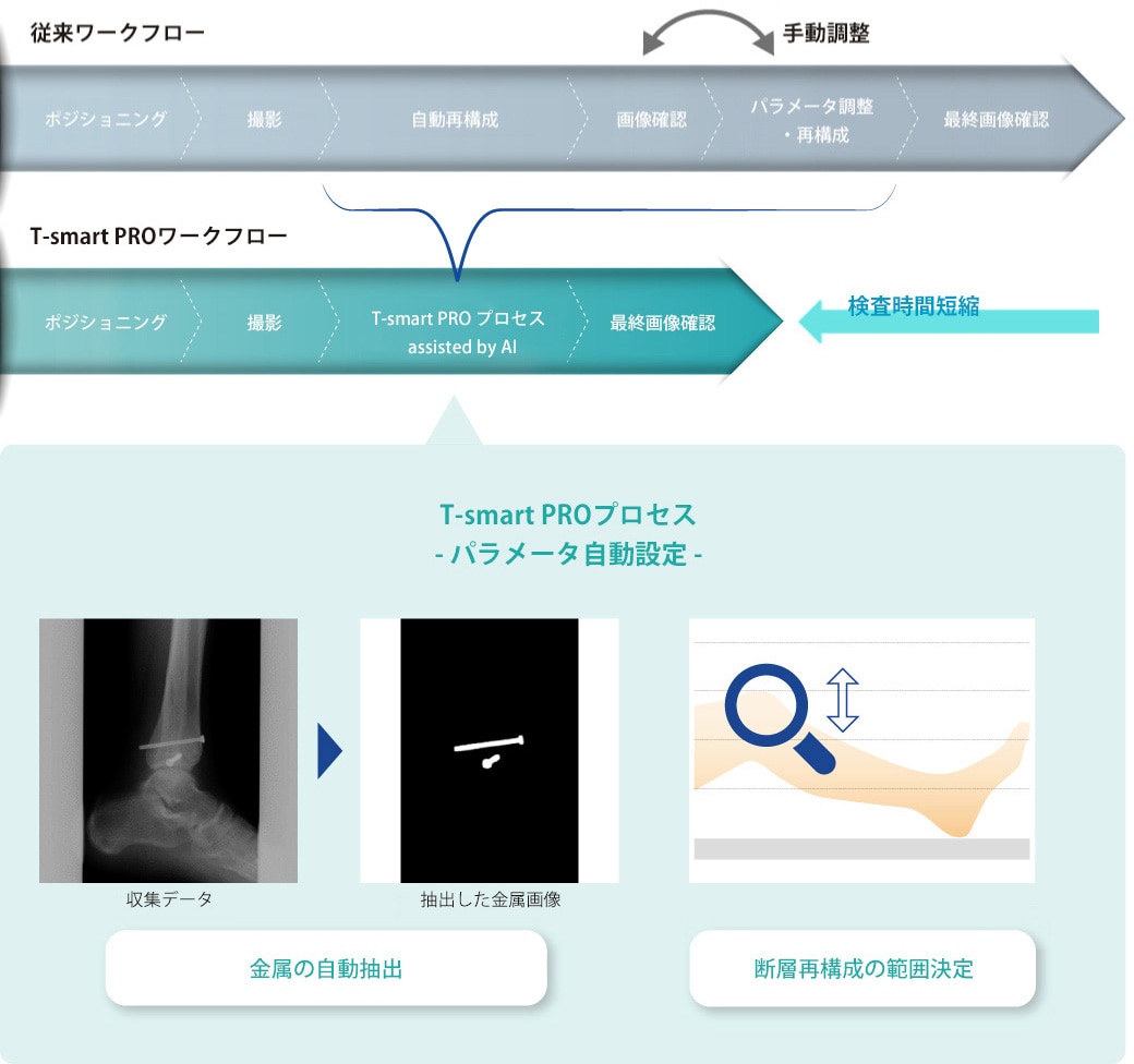 深層学習技術によるトモシンセシス検査の効率化